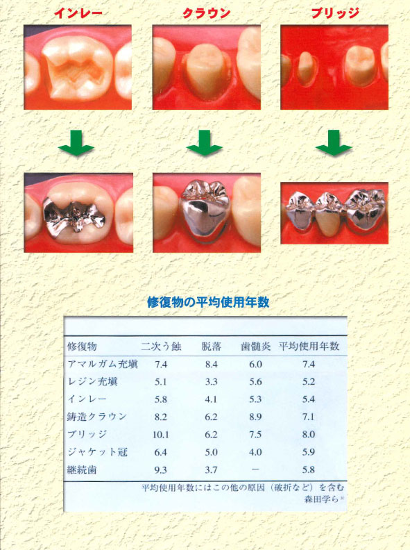 歯科予防