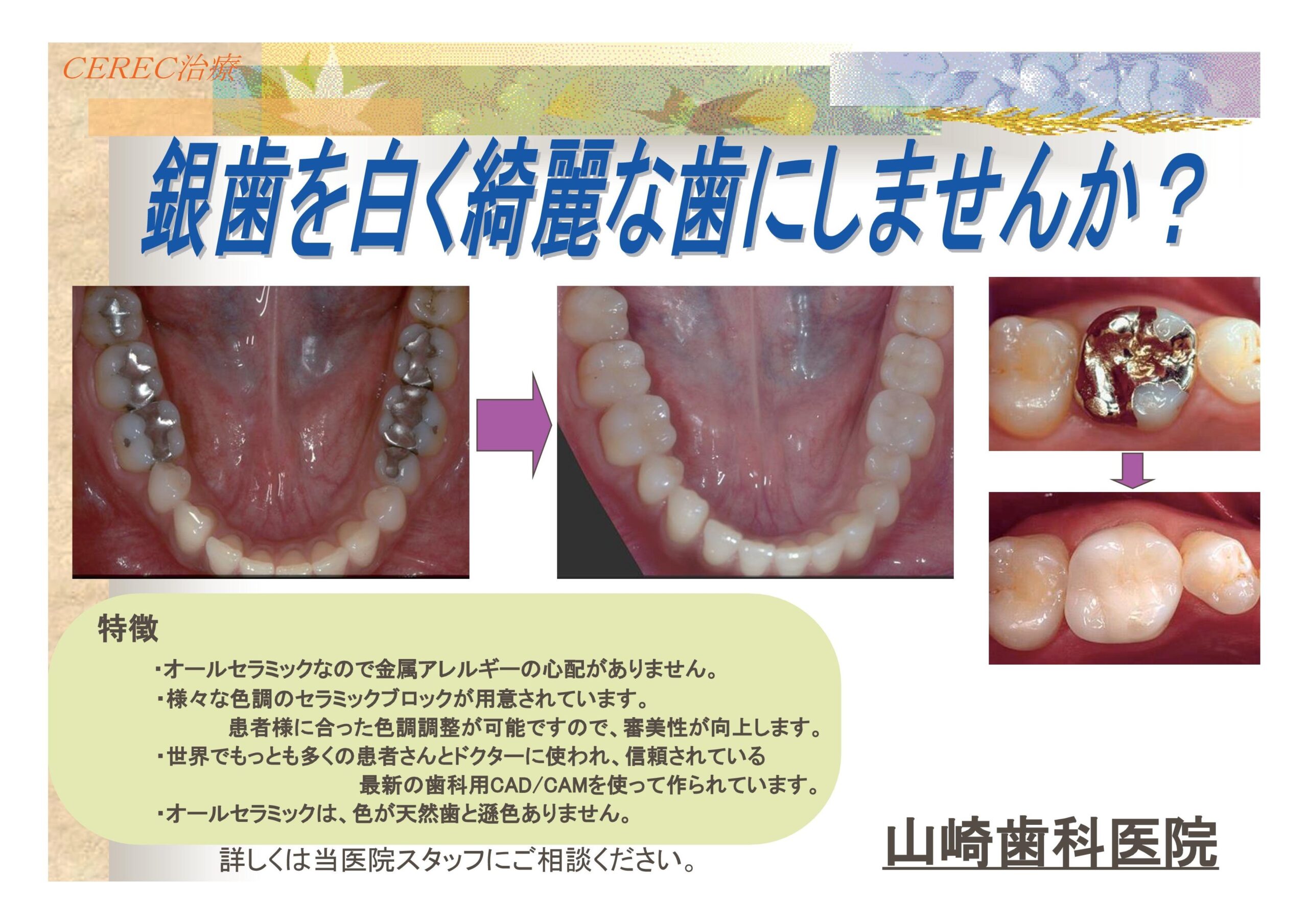 審美治療 | 医療法人 山崎歯科医院